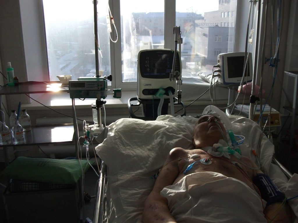 17 day of violent "reanimation" closed from society and children, after arranged INSULT! Glucose infusion is continues, causing of a second insult, cerebral edema with extrusion from the cranium, infection of blood, organs failure …