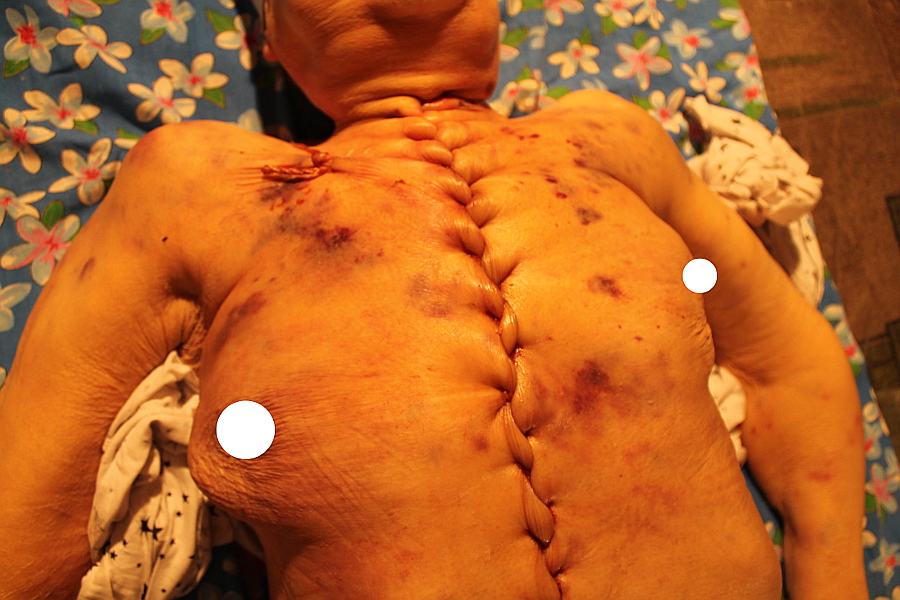 Writer Ganova Ludmila - Murder in Closed Hospital 20.11.18 with traces of tortures